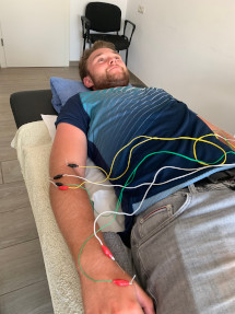 neuromodulation-and-electropunction-calvia-mallorca-dry-needles-mans-arm