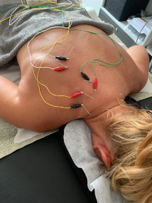 neuromodulation-and-electropunction-calvia-mallorca-treatment-on-womans-shoulders