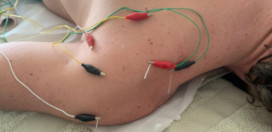 sports-physiotherapy-calvia-mallorca-conditioning-neuromodulation